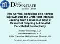Irido-Corneal Adhesions and Fibrous Ingrowth into the Graft-Host Interface Causing Graft Failure in a Case of Descemet Stripping Automated Endothelial Keratoplasty PowerPoint PPT Presentation