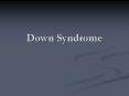 Down Syndrome PowerPoint PPT Presentation