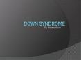 Down Syndrome PowerPoint PPT Presentation
