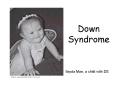 Down Syndrome PowerPoint PPT Presentation