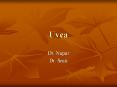 Uvea PowerPoint PPT Presentation