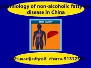 Epidemiology of non-alcoholic fatty liver