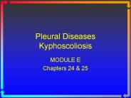 Pleural Diseases Kyphoscoliosis