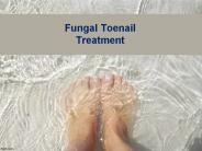Fungal Toenail Treatment