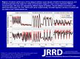 Pulliam CL, Lambrecht JM, Kirsch RF. Electromyogram-based neural network control of transhumeral prostheses. J Rehabil Res Dev. 2011;48(6):739-54. DOI:10.1682/JRRD.2010.12.0237 PowerPoint PPT Presentation