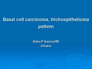 Basal cell carcinoma, trichoepithelioma pattern