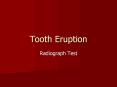 Tooth Eruption PowerPoint PPT Presentation