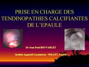 PRISE EN CHARGE DES TENDINOPATHIES CALCIFIANTES DE L