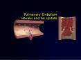 Pulmonary Embolism PowerPoint PPT Presentation