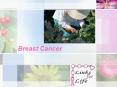 Breast Cancer PowerPoint PPT Presentation