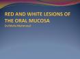 RED AND WHITE LESIONS OF THE ORAL MUCOSA Dr/Maha Mahmoud PowerPoint PPT Presentation
