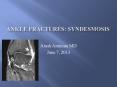 Ankle Fractures: syndesmosis PowerPoint PPT Presentation