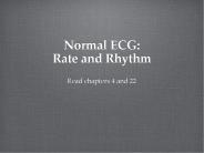 Normal ECG: Rate and Rhythm