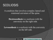 SCOLIOSIS