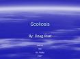 Scoliosis PowerPoint PPT Presentation