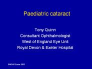 Paediatric%20cataract