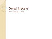Dental Implants