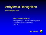 Arrythmia recognition