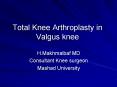 Total Knee Arthroplasty in Valgus knee PowerPoint PPT Presentation