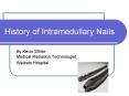 History of Intramedullary Nails PowerPoint PPT Presentation