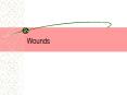 Wounds PowerPoint PPT Presentation