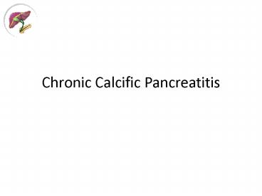 Chronic Calcific Pancreatitis