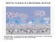 DENTAL PLAQUE IS A MICROBIAL BIOFILM PowerPoint PPT Presentation