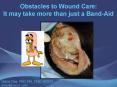 Obstacles to Wound Care:                        It may take more than just a Band-Aid PowerPoint PPT Presentation