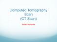 Computed Tomography Scan (CT Scan) PowerPoint PPT Presentation
