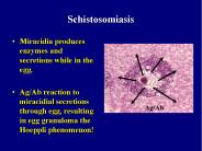 Schistosomiasis