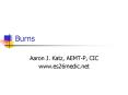 Burns PowerPoint PPT Presentation