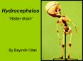 Hydrocephalus PowerPoint PPT Presentation