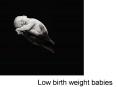 Low birth weight babies PowerPoint PPT Presentation