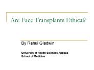 Are Face Transplants Ethical?