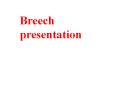 Breech presentation PowerPoint PPT Presentation