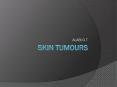 SKIN TUMOURS PowerPoint PPT Presentation