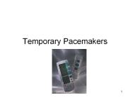 Temporary Pacemakers
