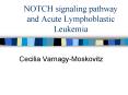 NOTCH signaling pathway and Acute Lymphoblastic Leukemia PowerPoint PPT Presentation
