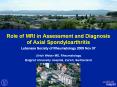 Role of MRI in Assessment and Diagnosis of Axial Spondyloarthritis PowerPoint PPT Presentation