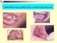 Clasificaci