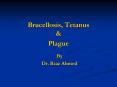 Brucellosis, Tetanus PowerPoint PPT Presentation