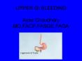 UPPER GI BLEEDING Ayaz Chaudhary MD,FACP,FASGE,FAGA PowerPoint PPT Presentation