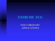 EXERCISE ECG