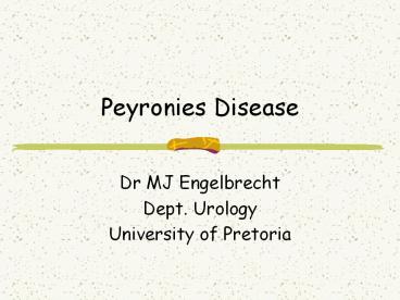 Peyronies Disease