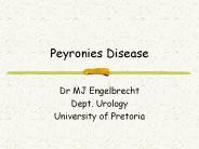 Peyronies Disease