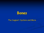 Bones