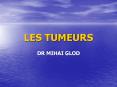 LES TUMEURS PowerPoint PPT Presentation