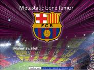 Metastatic bone tumor