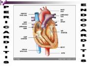 PERICARDITIS