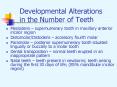 Developmental Alterations in the Number of Teeth PowerPoint PPT Presentation